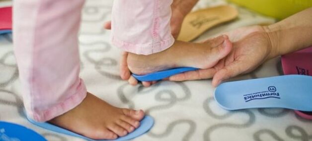 Vorlagen mit der Verformung von Valgo del Pie bei Kindern